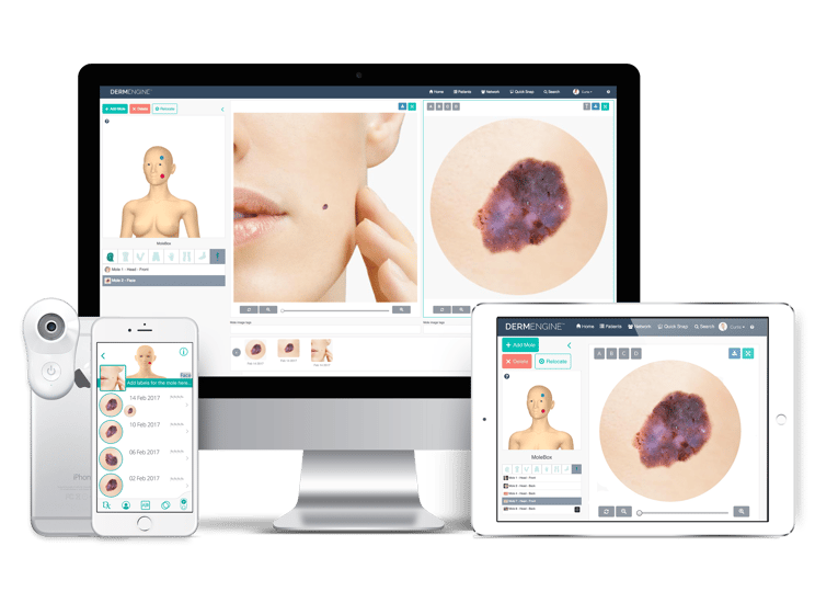 DermEngine MoleScope II cross platform