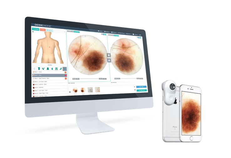 DermEngine Intelligent dermatology Software