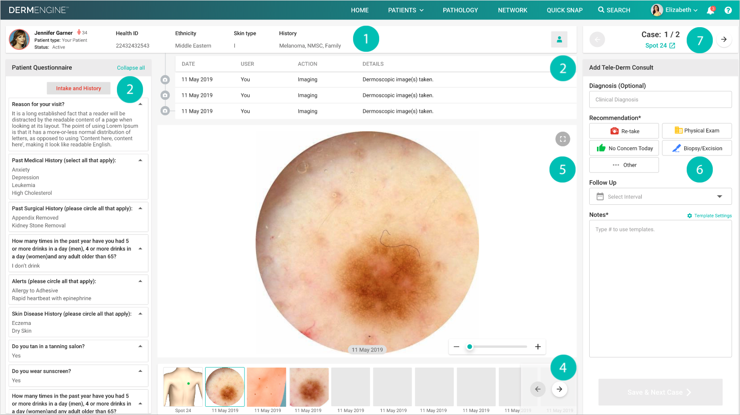 DermEngine Teledermatology Panel Numbered