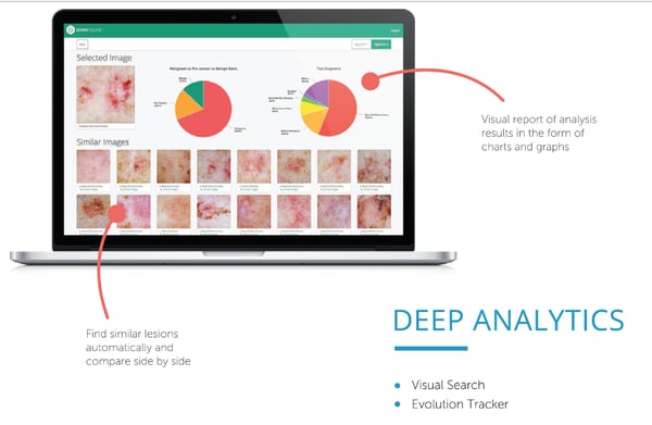 DermEngine deep analytics artificial intelligence in dermatology CBIR