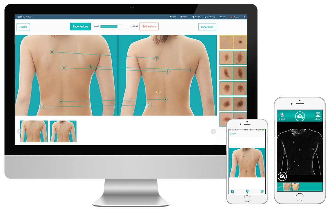 DermEngine full body imaging cross platform