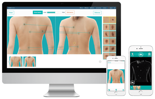 DermEngine Full Body Imaging Cross Platform