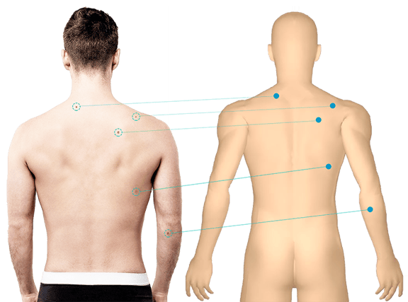 DermEngine Total Body Photography Software