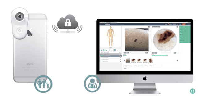 MoleScope DermEngine Store and Forward Teledermatology