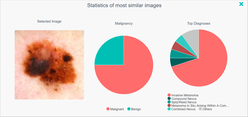 DermEngine Content Based Image Retrieval Artificial Intelligence (CBIR)