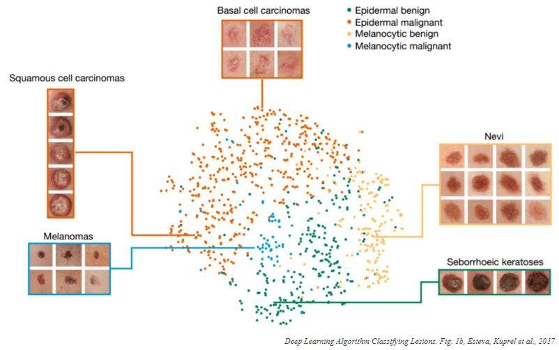 Deep Learning Algorithm Classifying Lesions