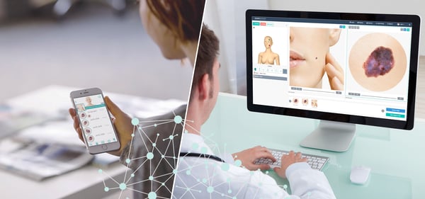 Deferred analysis of overview and dermoscopic images sent by patient to teledermatology consultant.