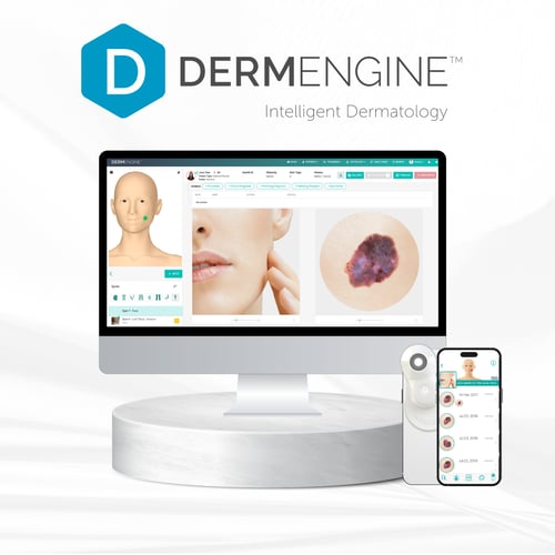 DermEngine - Mole Mapping Software (1)