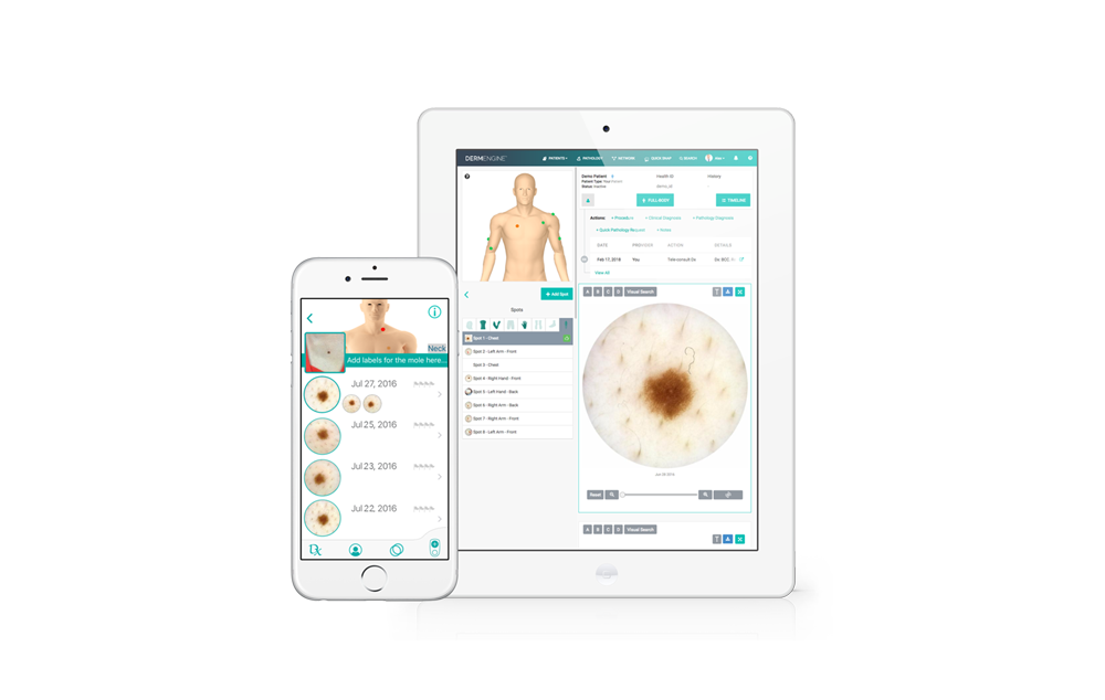 Intelligent Dermatology Software - iOS