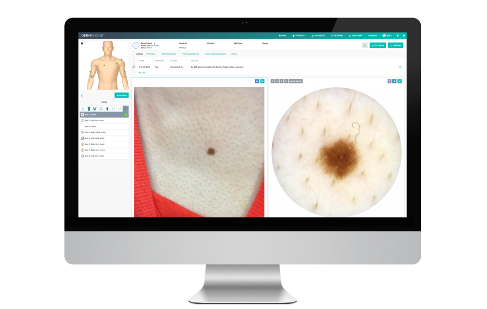 DermEngine | The Most Intelligent Dermatology Platform