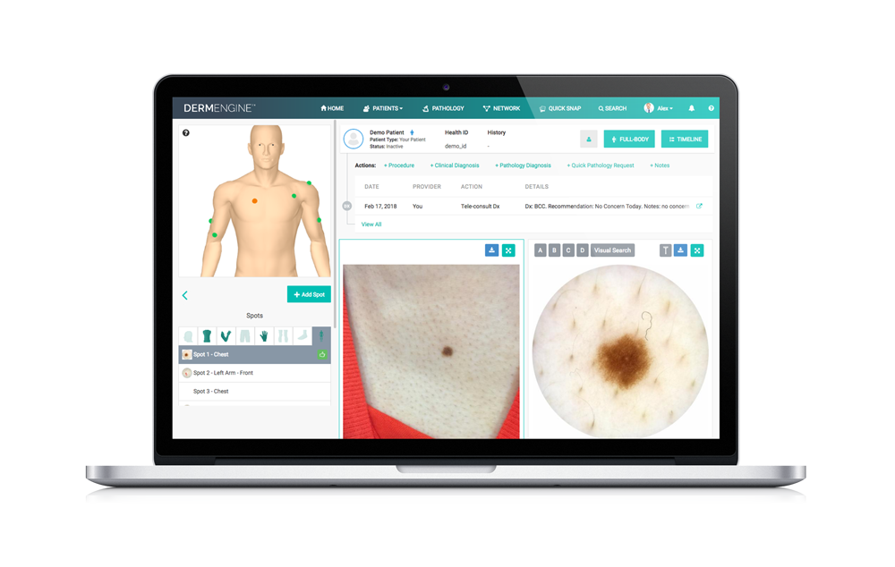Intelligent Dermatology Software - Web