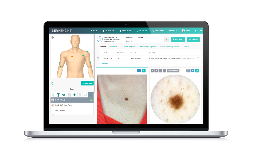 Dermengine Kit DermEngine | The Most Intelligent Dermatology Platform