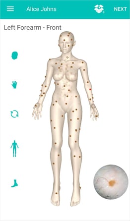 DermEngine 3D Body Map Spot Identification