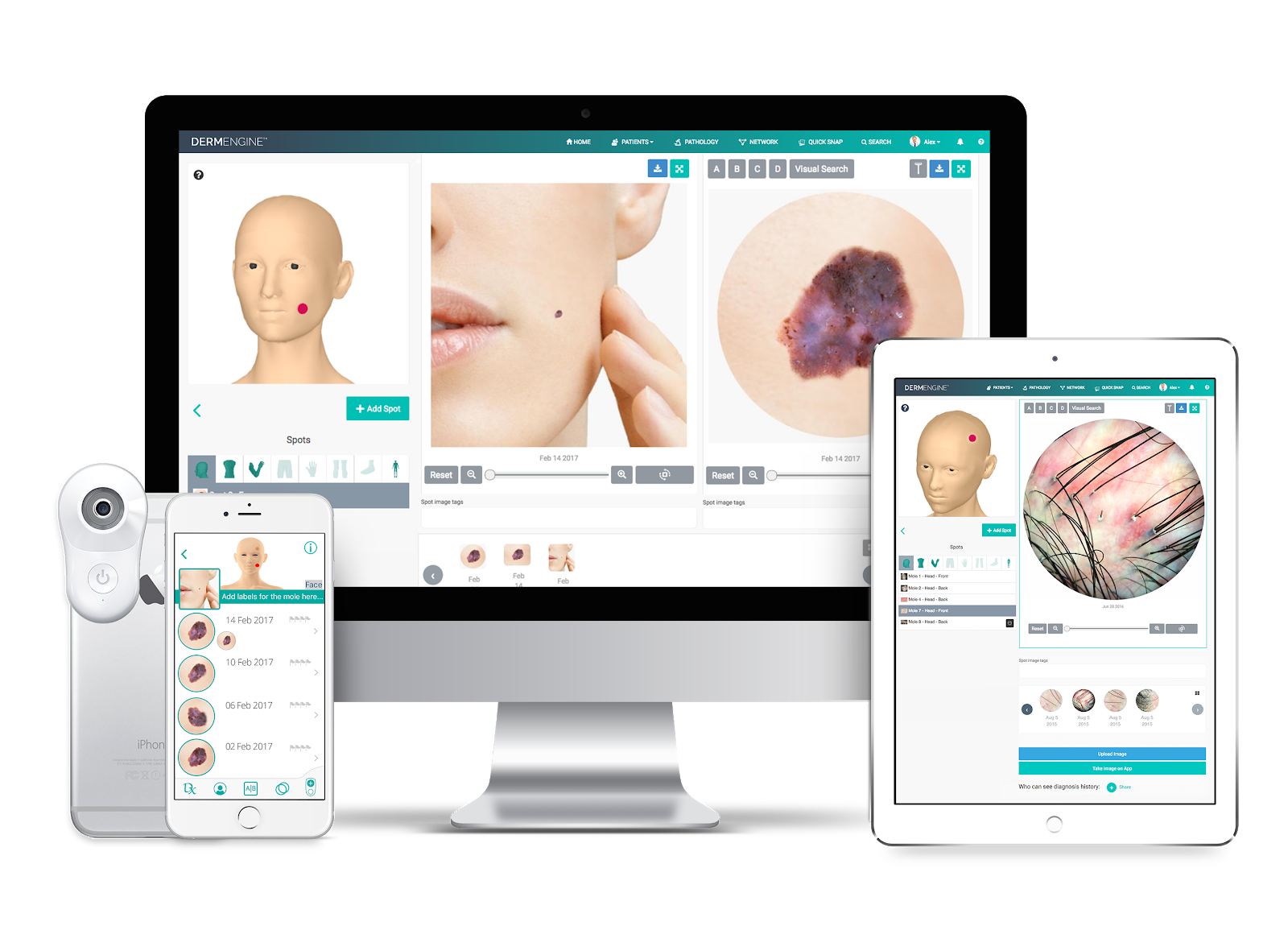 DermEngine Intelligent Dermatology Mobile Devices