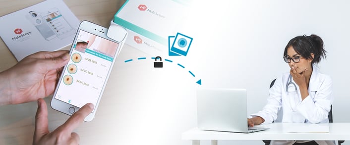 DermEngine MoleScope patient teledermatology