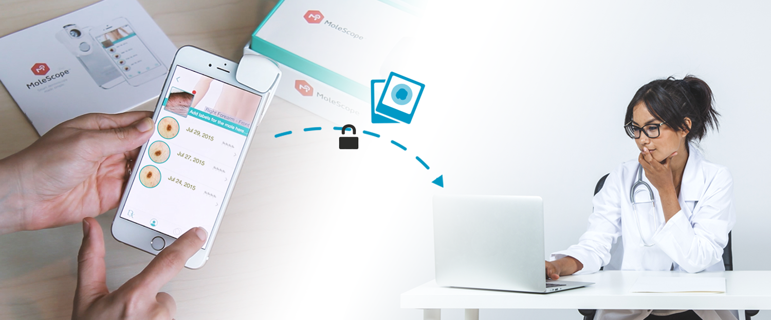 DermEngine MoleScope patient teledermatology