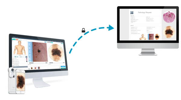 DermEngine Safe Transfer and Process of Personal Data