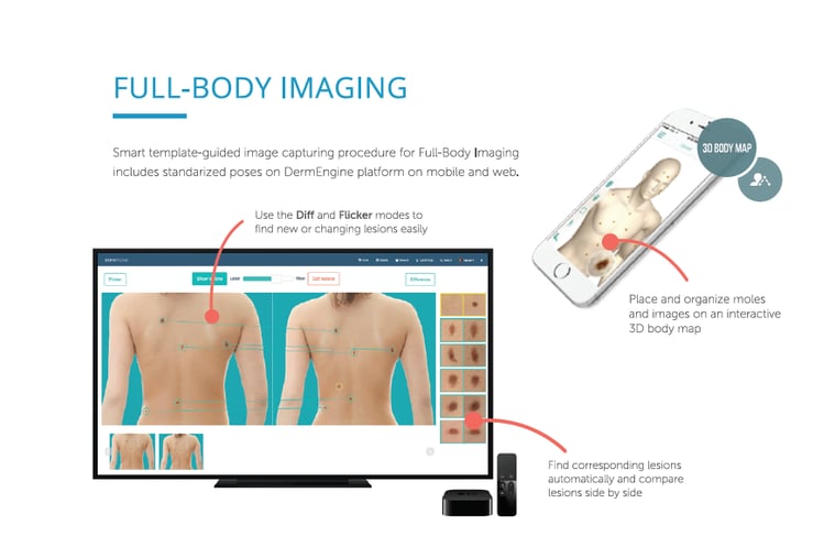 DermEngine Total Body Photography MoleScope