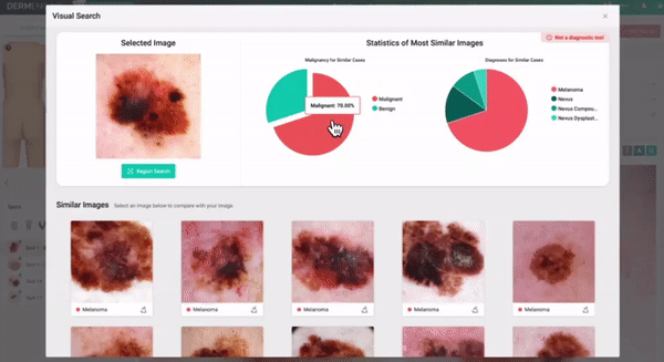 DermEngine Visual Search Clinical Decision Support Tool