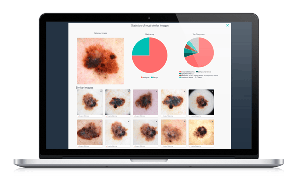 DermEngine Visual Search Clinical Decision Support Tool