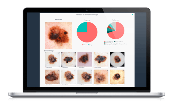 VisualSearch is an intelligent tool in DermEngine powered by algorithms trained on large sets of big data. 