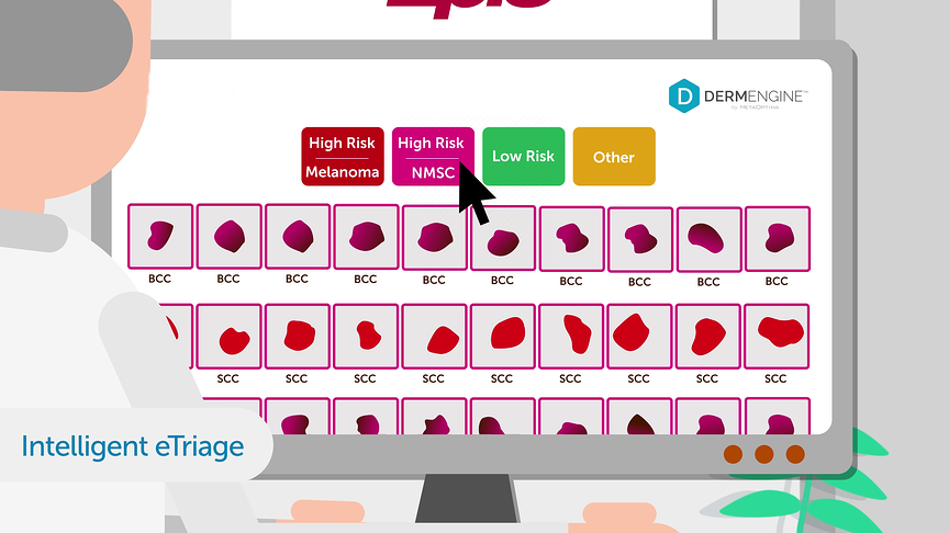 DermEngine intelligent dermatology AI tools for clinical decision support and etriage
