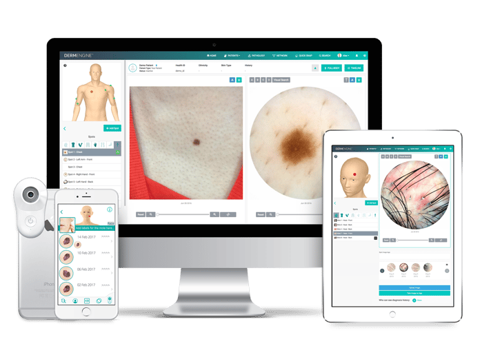 DermEngine-MoleScope Cross-platform accessibility