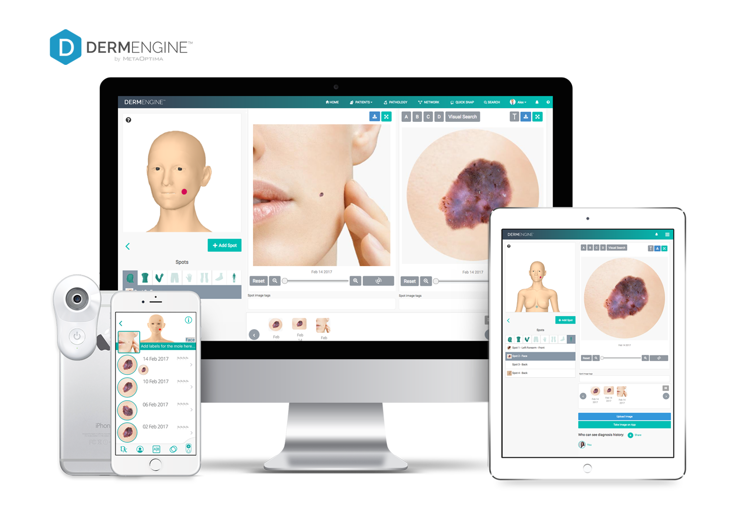 DermEngine Intelligent Dermatology Software 