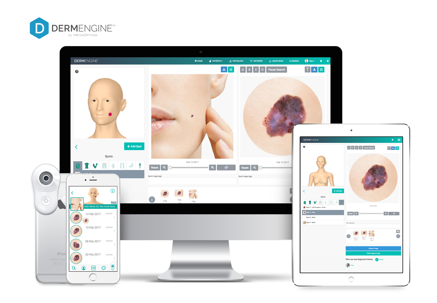 DermEngine Intelligent Dermatology Software 