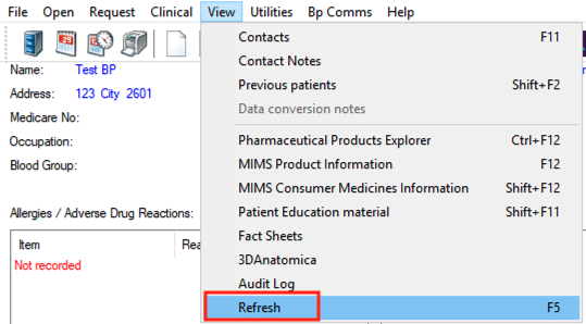 timeline-report-refresh