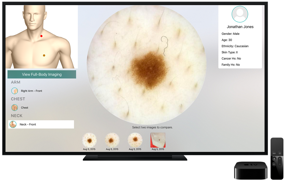 DermEngine | The World's Most Advanced Skin Analytics System