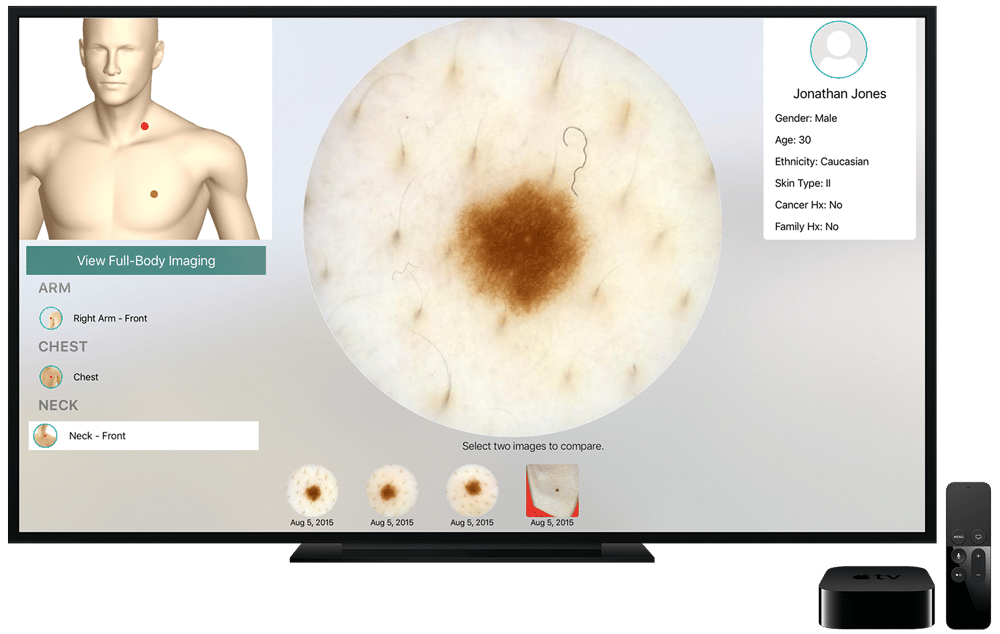 DermEngine | The World's Most Advanced Skin Analytics System