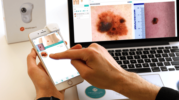 Doctor using DermEngine for clinical analysis copy-4