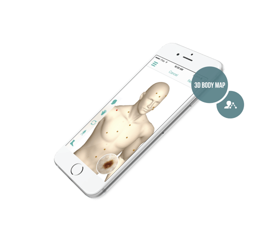 MoleScope App 3D Body Map