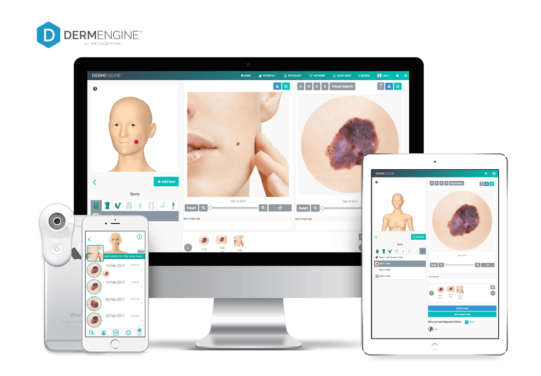 DermEngine_devices_MoleScopeII-New