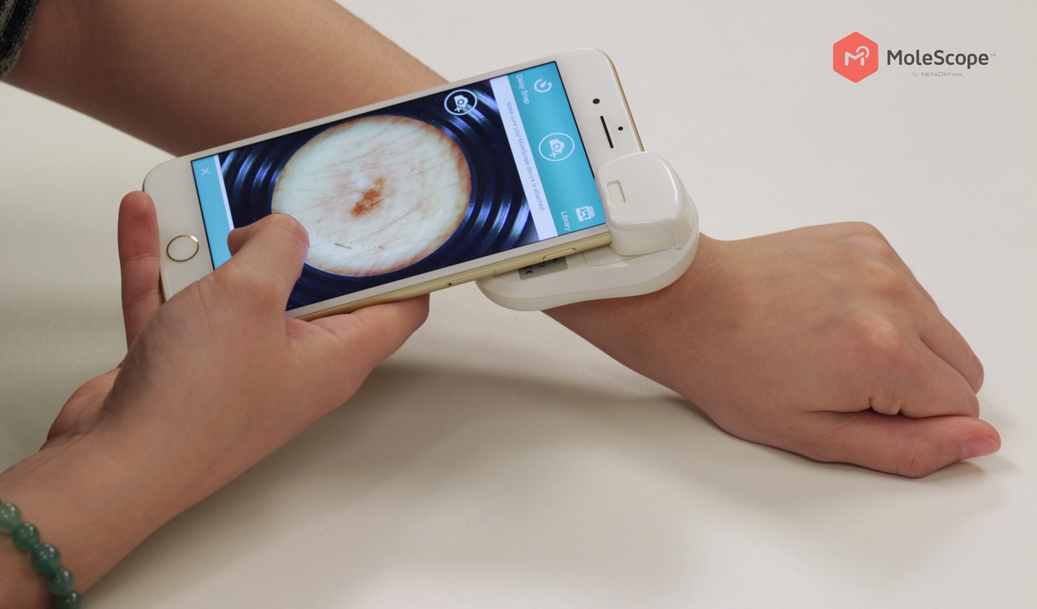MoleScope Skin Cancer App And Device for Digital Dermoscopy