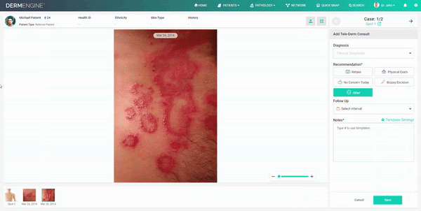 DermEngine Teledermatology Software General Dermatology Panel GIF
