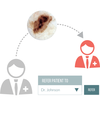 A Physician Referring A Patient Case To A Dermatologist For Further Review Via Teledermoscopy Software