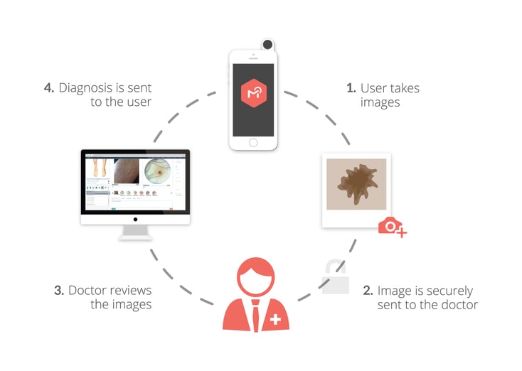 MoleScope Patient Cycle DermEngine