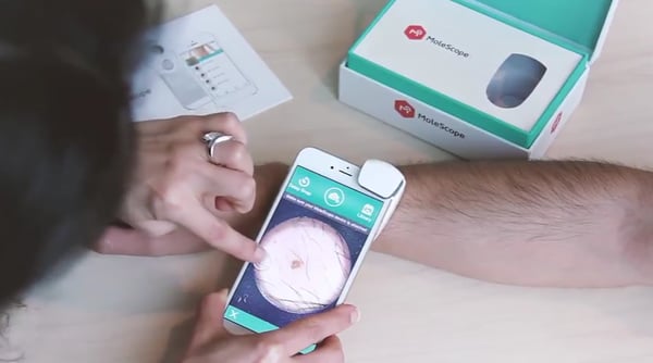 DermEngine app installed on mobile device for the use of MoleScope II in dermoscopy practice.
