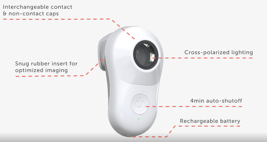 MoleScope - Mobile Dermoscope - Skin Cancer App