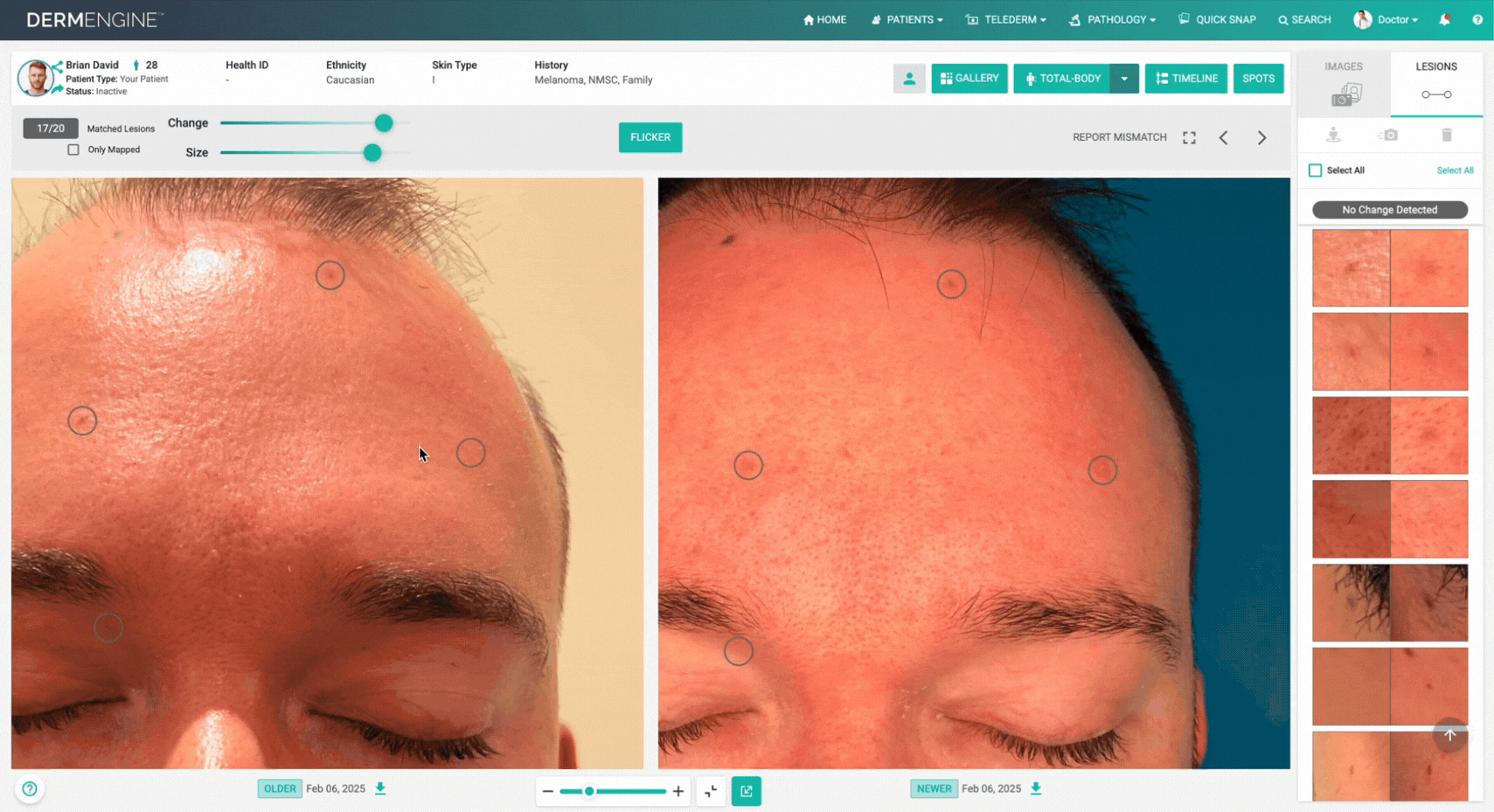 OptimaLight Comparison. GIF