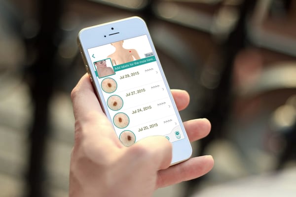 Patients can utilize their phones with a mobile dermoscope attached to take pictures of compromised spots.
