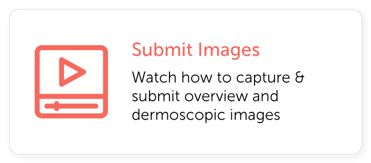 Submit Images MoleScope