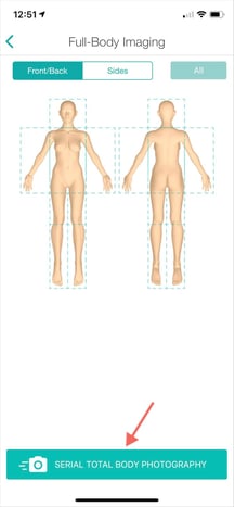 Serial Total Body Imaging