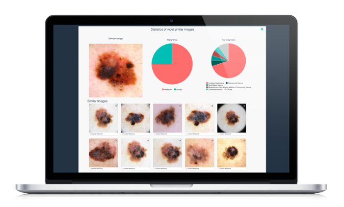Intelligent Dermatology Software ( Dermengine's VisualSearch )