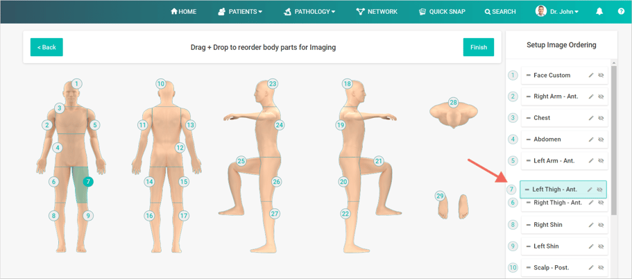 Create Imaging Order Total Body Photography