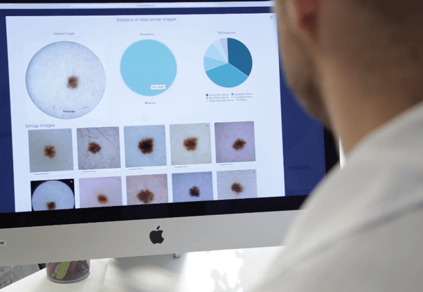 Intelligent Dermatology AI feature called Visual Search from MetaOptima's DermEngine