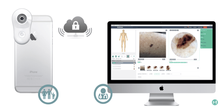 DermEngine MoleScope II Secure Teledermoscopy