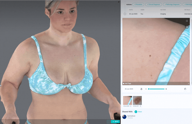 Automated Total Body Photography